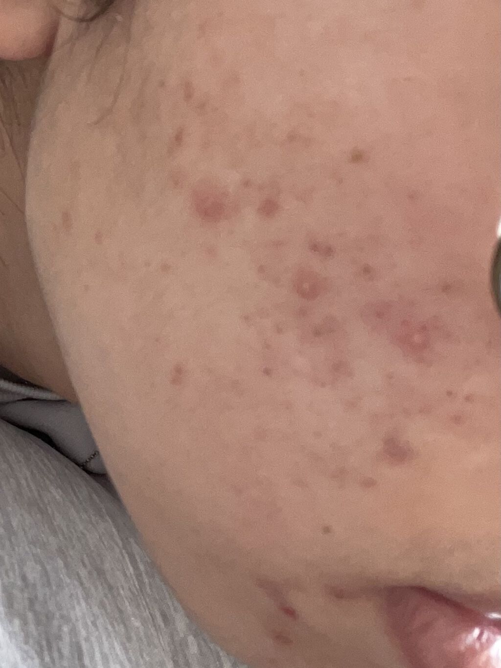 ウオーター/アベンヌ/ミスト状化粧水を使ったクチコミ（3枚目）