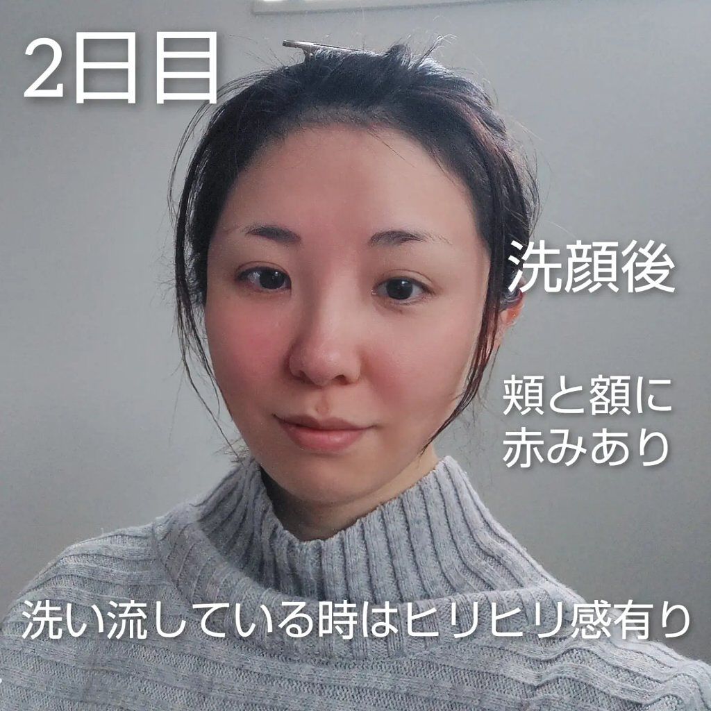 を使ったクチコミ（3枚目）