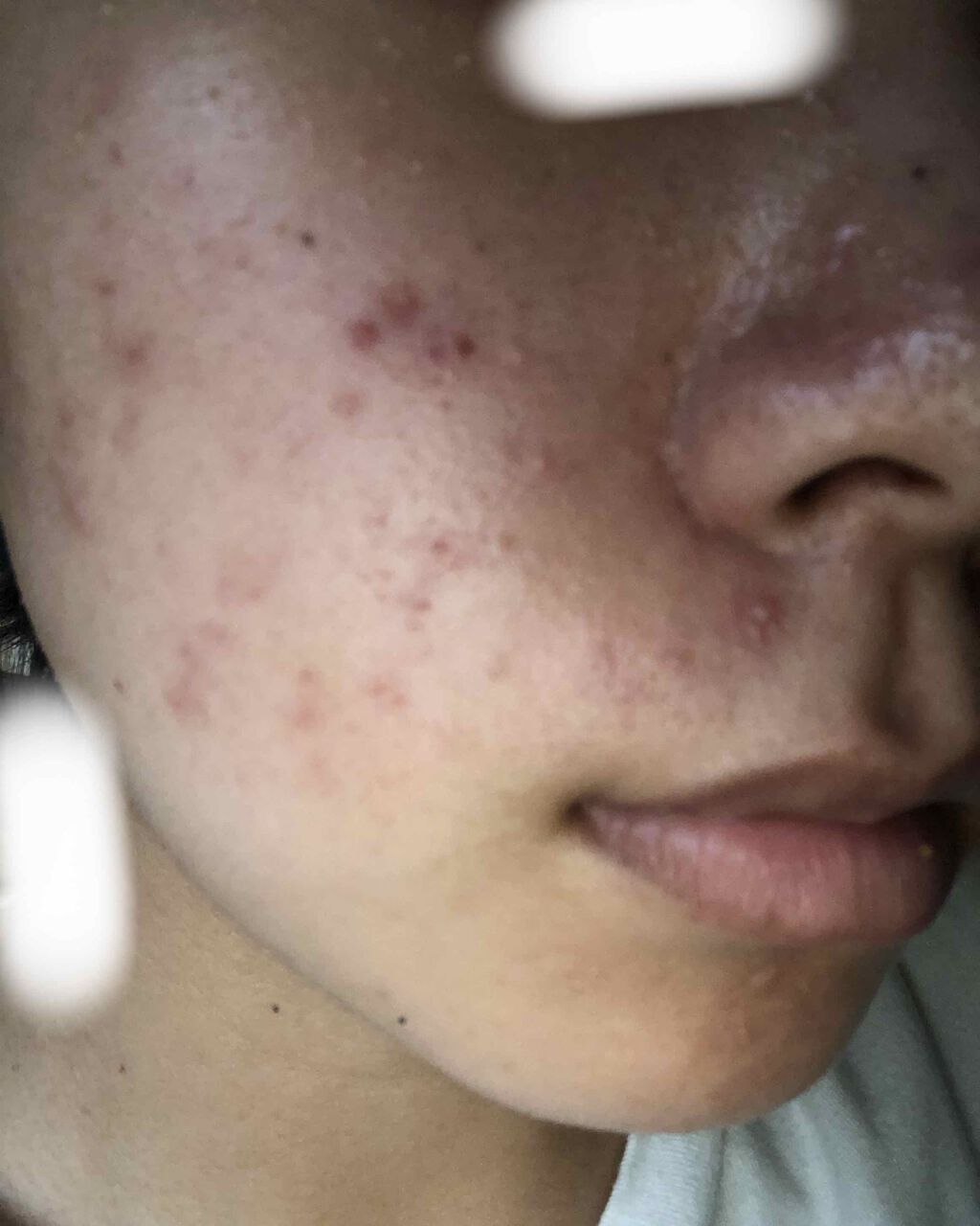 林 on LIPS 「初めまして!初投稿です…画像を見て不快になられた方もいると思い..」(2枚目)