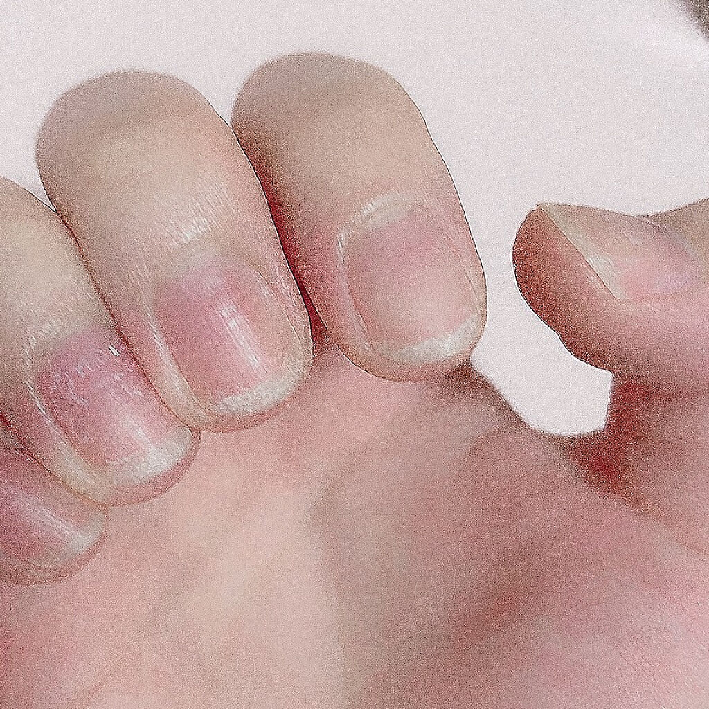 グロウケアコート/デュカート/ネイルオイル・トリートメントを使ったクチコミ（2枚目）