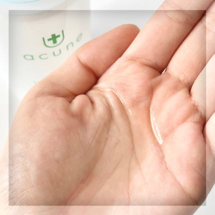 アキュネ 薬用ふきとりローションU/アキュネ/拭き取り化粧水を使ったクチコミ(5枚目)