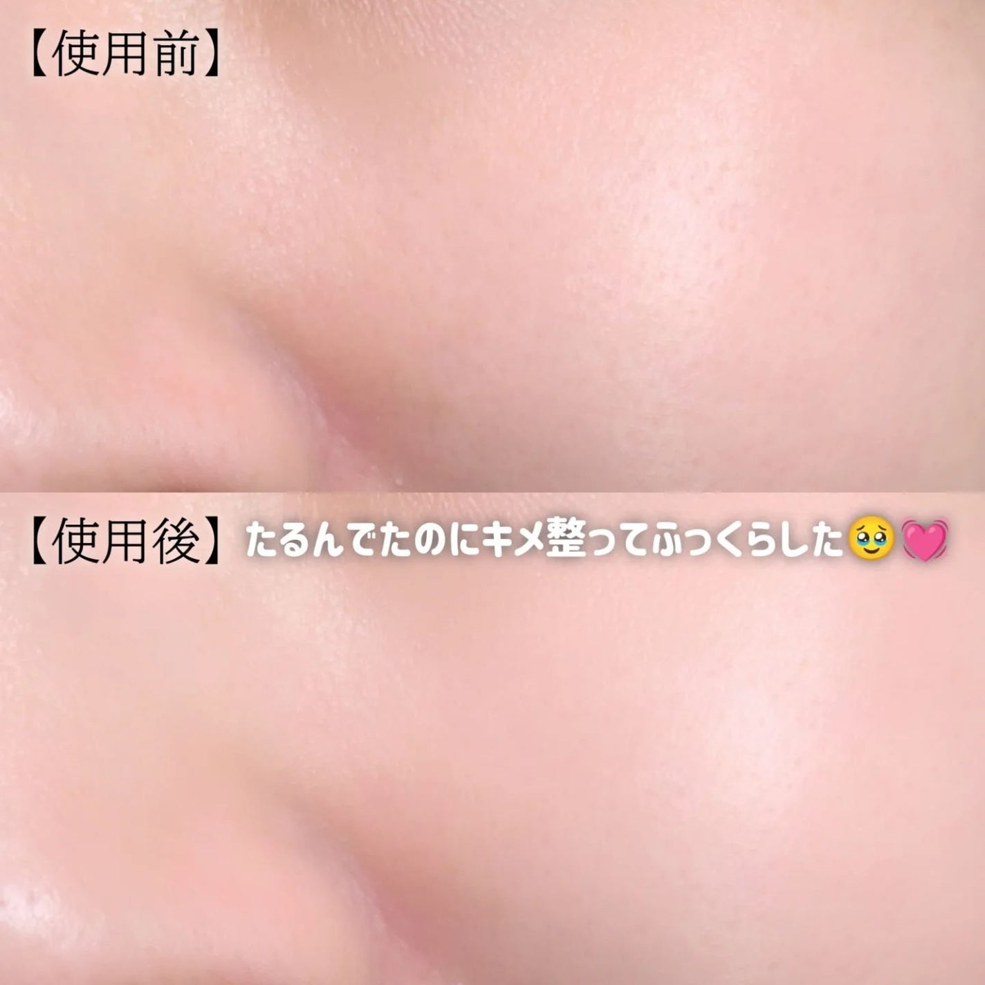 PDRNショット675/COSNORI/美容液を使ったクチコミ(3枚目)