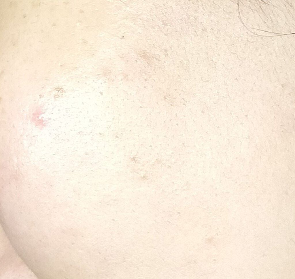 高浸透うるおい化粧液/SQS/化粧水を使ったクチコミ(4枚目)