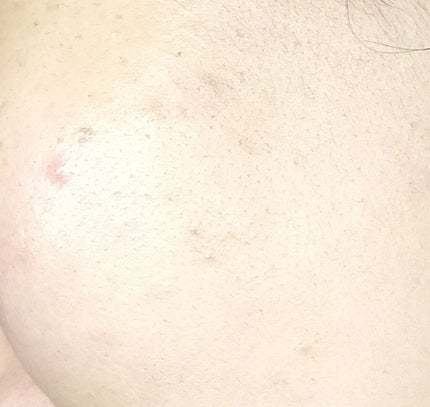 高浸透うるおい化粧液/SQS/化粧水を使ったクチコミ(4枚目)