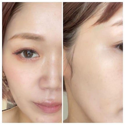 ブライトニング デーケアレボリューション WT+/エリクシール/乳液を使ったクチコミ(6枚目)