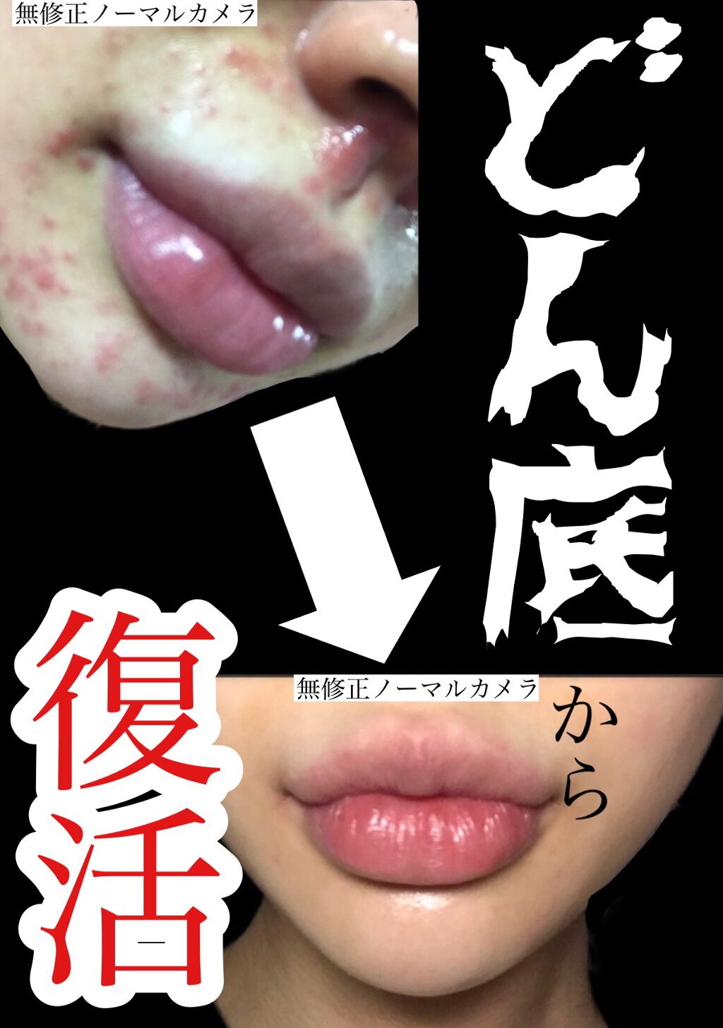 清上防風湯 セイジョウボウフウトウ(医薬品)/ツムラ/その他を使ったクチコミ(2枚目)