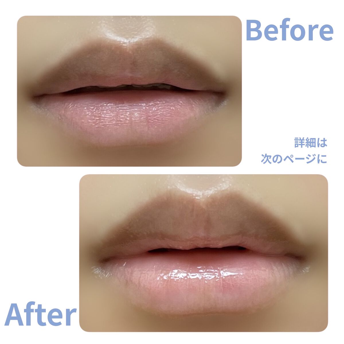 ドトムリッププラスプランパー/keybo/リッププランパーを使ったクチコミ（3枚目）