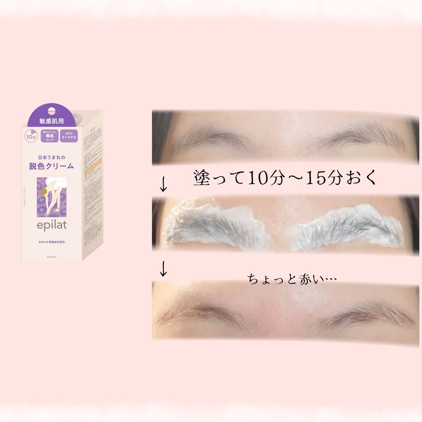 脱色クリーム 敏感肌用/エピラット/ムダ毛ケアを使ったクチコミ(2枚目)