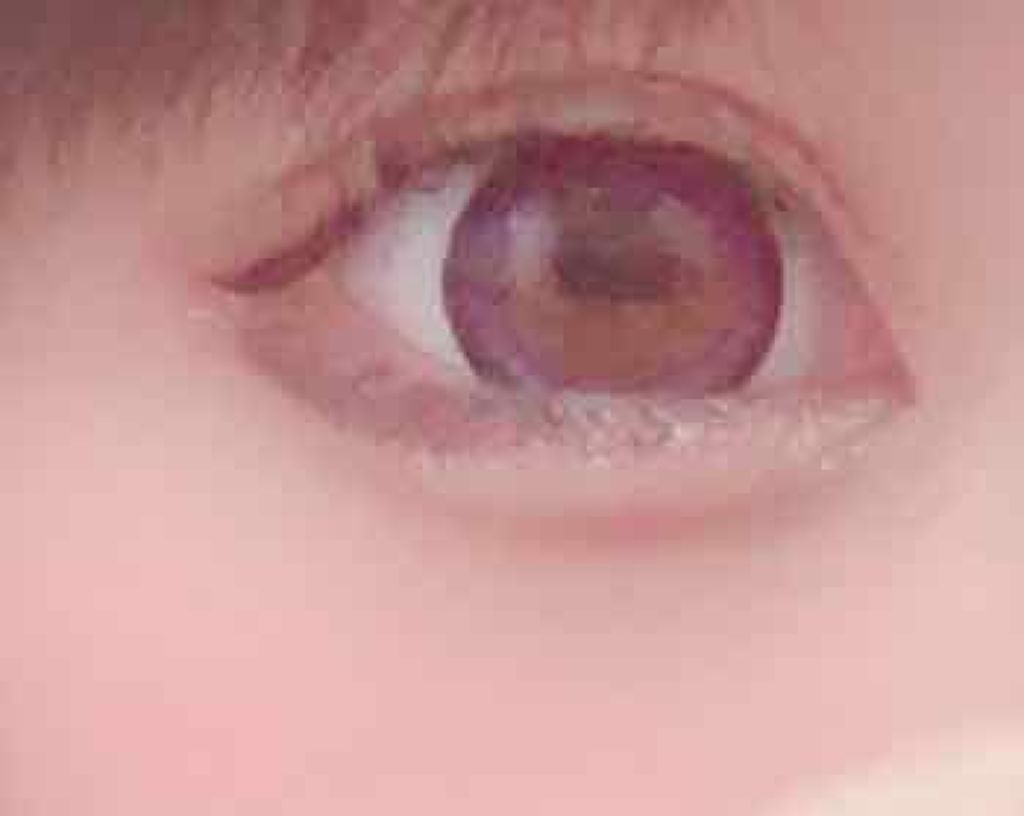 loveil 1day /loveil/ワンデー(1DAY)カラコンを使ったクチコミ(3枚目)