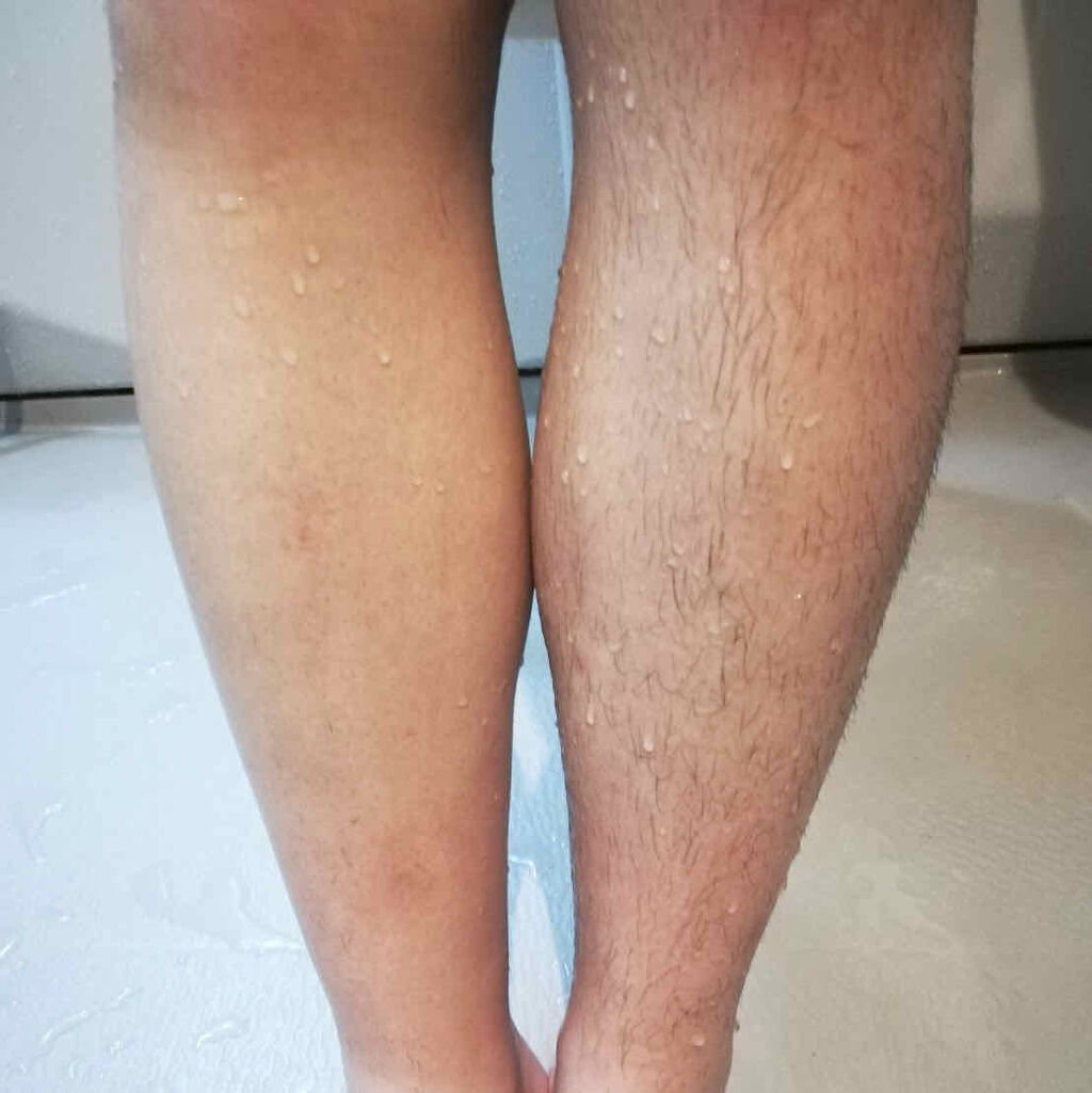 ZERO CLEAN・クリーム/美健コーポレーション/除毛クリームを使ったクチコミ（2枚目）