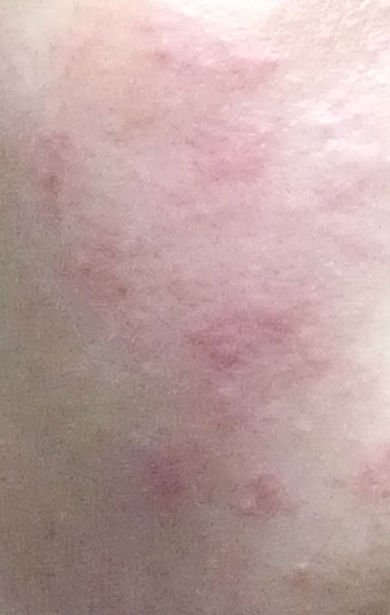 スキンケア洗顔料 モイスチャー/ビオレ/洗顔フォームを使ったクチコミ(2枚目)