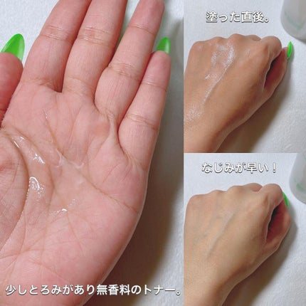 シカ80%ヒアルロン酸トナー/Frankly/化粧水を使ったクチコミ(3枚目)