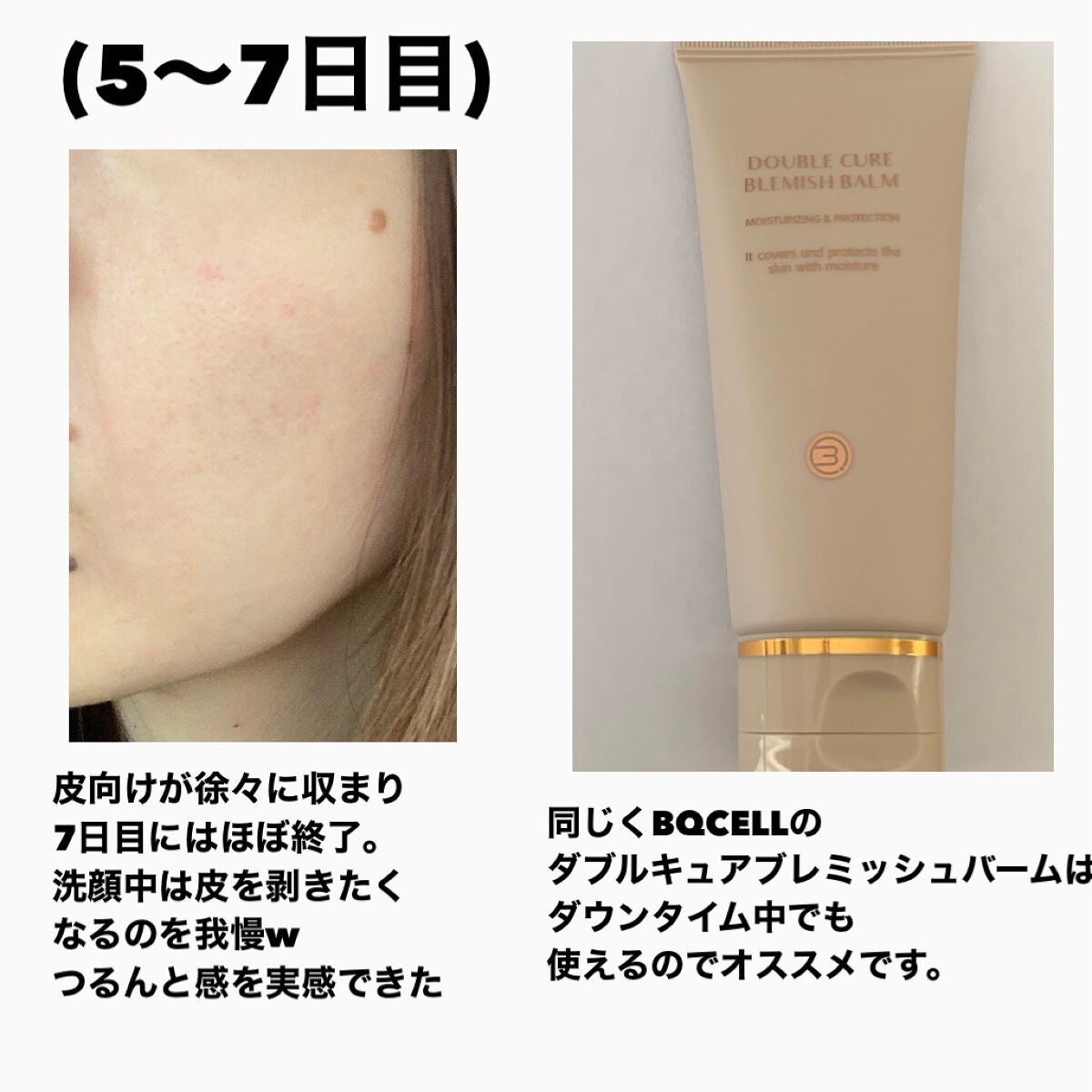 ダーマスキンピーリング/BQCELL/その他キットセットを使ったクチコミ(7枚目)