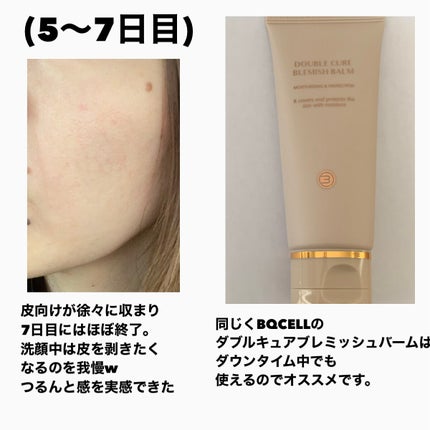 ダーマスキンピーリング/BQCELL/その他キットセットを使ったクチコミ(7枚目)