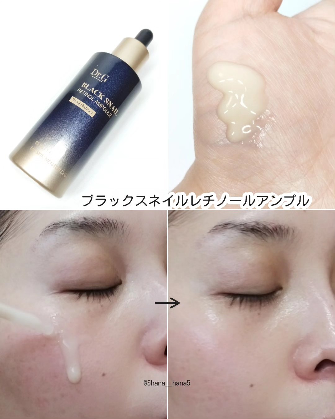 ブラックスネイルレチノールセラム/Dr.G/美容液を使ったクチコミ（3枚目）