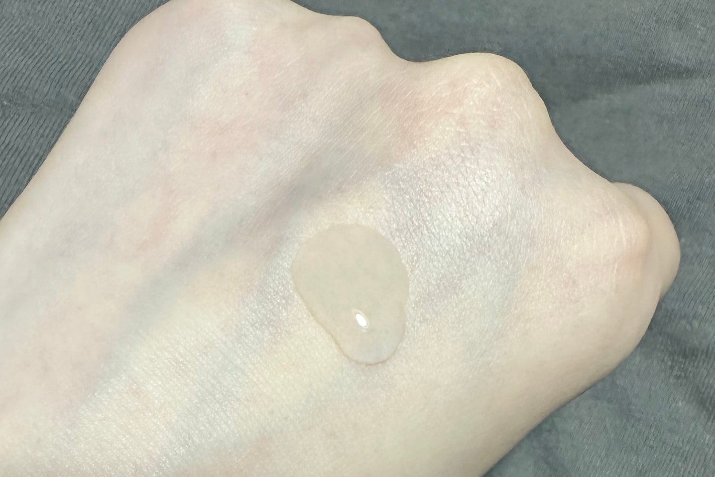 ダーマレーザー スーパーVC100ローション(さっぱり)/クオリティファースト/化粧水を使ったクチコミ(3枚目)