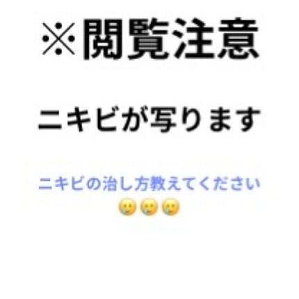 ニキビ治療薬(医薬品)/メンソレータム アクネス/その他を使ったクチコミ(1枚目)