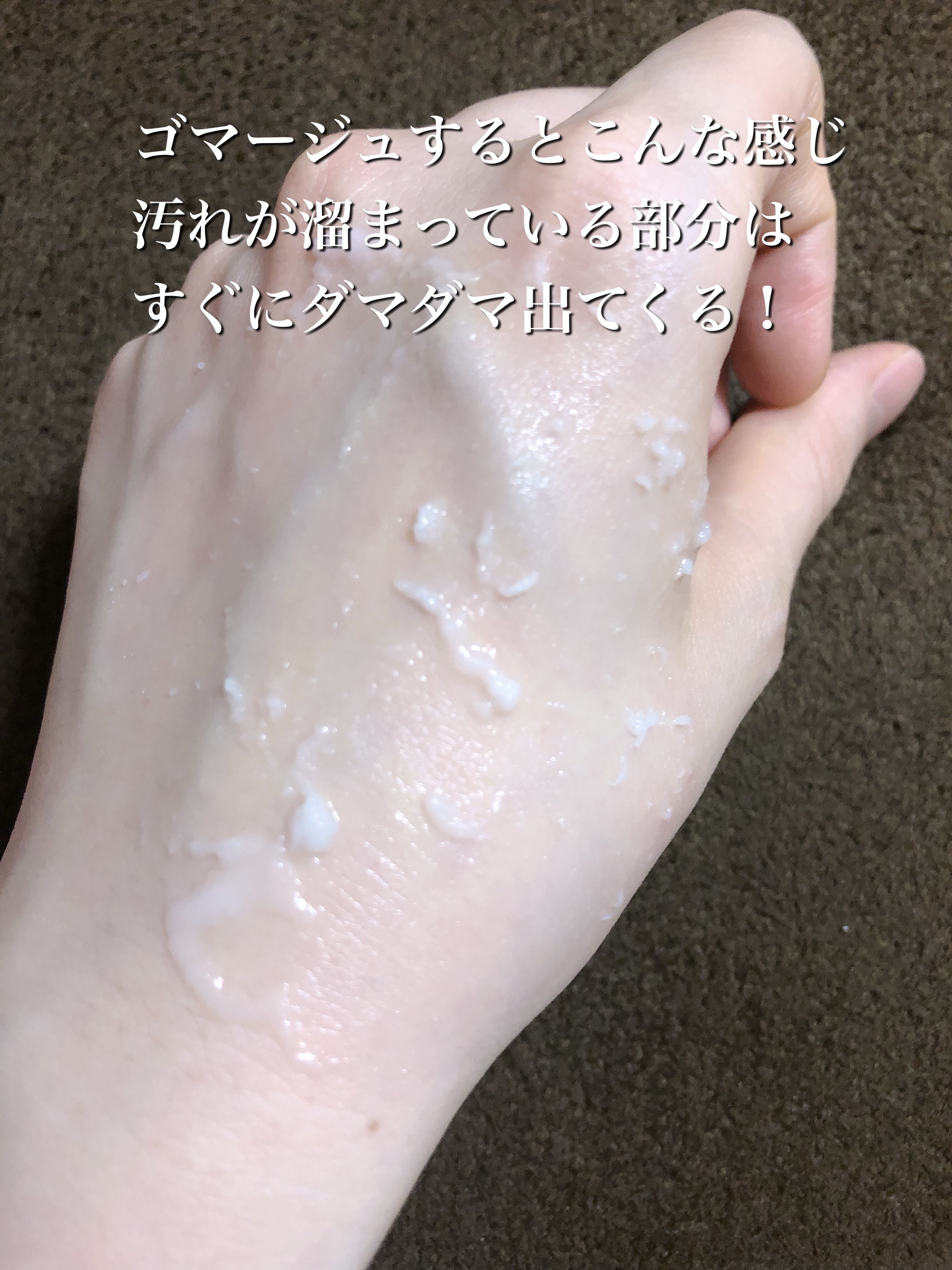 ブライトニングピーリングジェル/Dr.G/ピーリングを使ったクチコミ（3枚目）