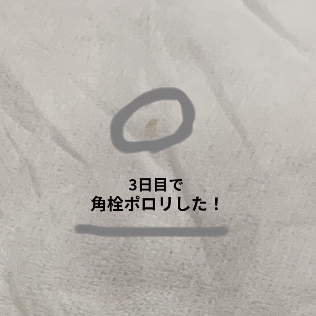 ジョンソンベビー ジョンソンベビーオイル微香性のクチコミ「Twitterで知る人ぞ知るベビーオイル洗顔を
続けてたら本当に角栓ポロリした！！！！


初.....」（2枚目）