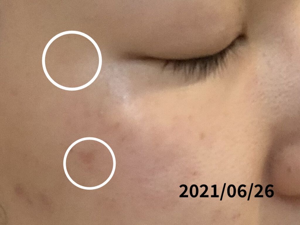 を使ったクチコミ（3枚目）