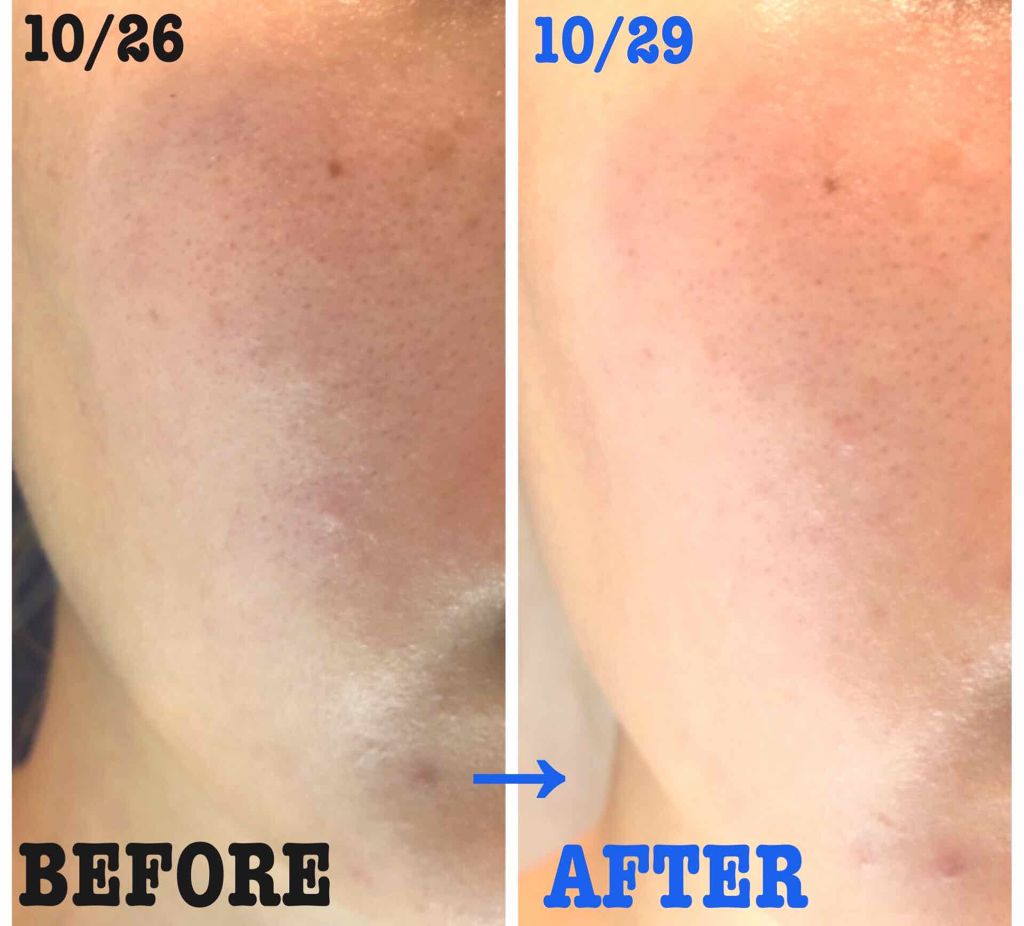 スパ・エ・メール ブラン コンフォール/Prédia/化粧水を使ったクチコミ（2枚目）