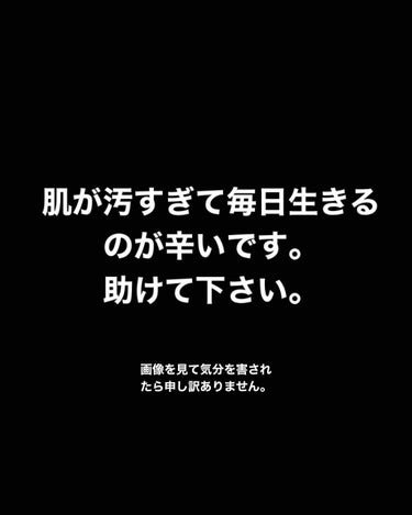 精製水（医薬品）/健栄製薬/その他を使ったクチコミ（1枚目）