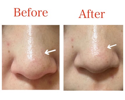 デュオ ザ ウォッシュ ブラックリペア/DUO/洗顔パウダーを使ったクチコミ(4枚目)