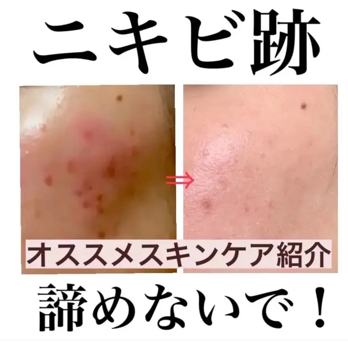 ホワイトニングクリアセラム/エトヴォス/美容液を使ったクチコミ（1枚目）