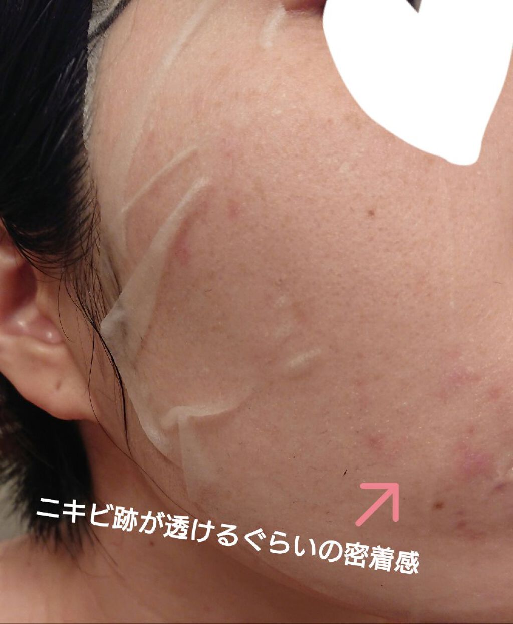 ティーツリーケアソリューション アンプルマスクJEX/MEDIHEAL/シートマスク・パックを使ったクチコミ(2枚目)