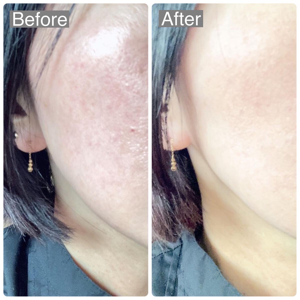 ナチュラルラディアント ロングウェア クッションファンデーション/NARS/クッションファンデーションを使ったクチコミ(7枚目)