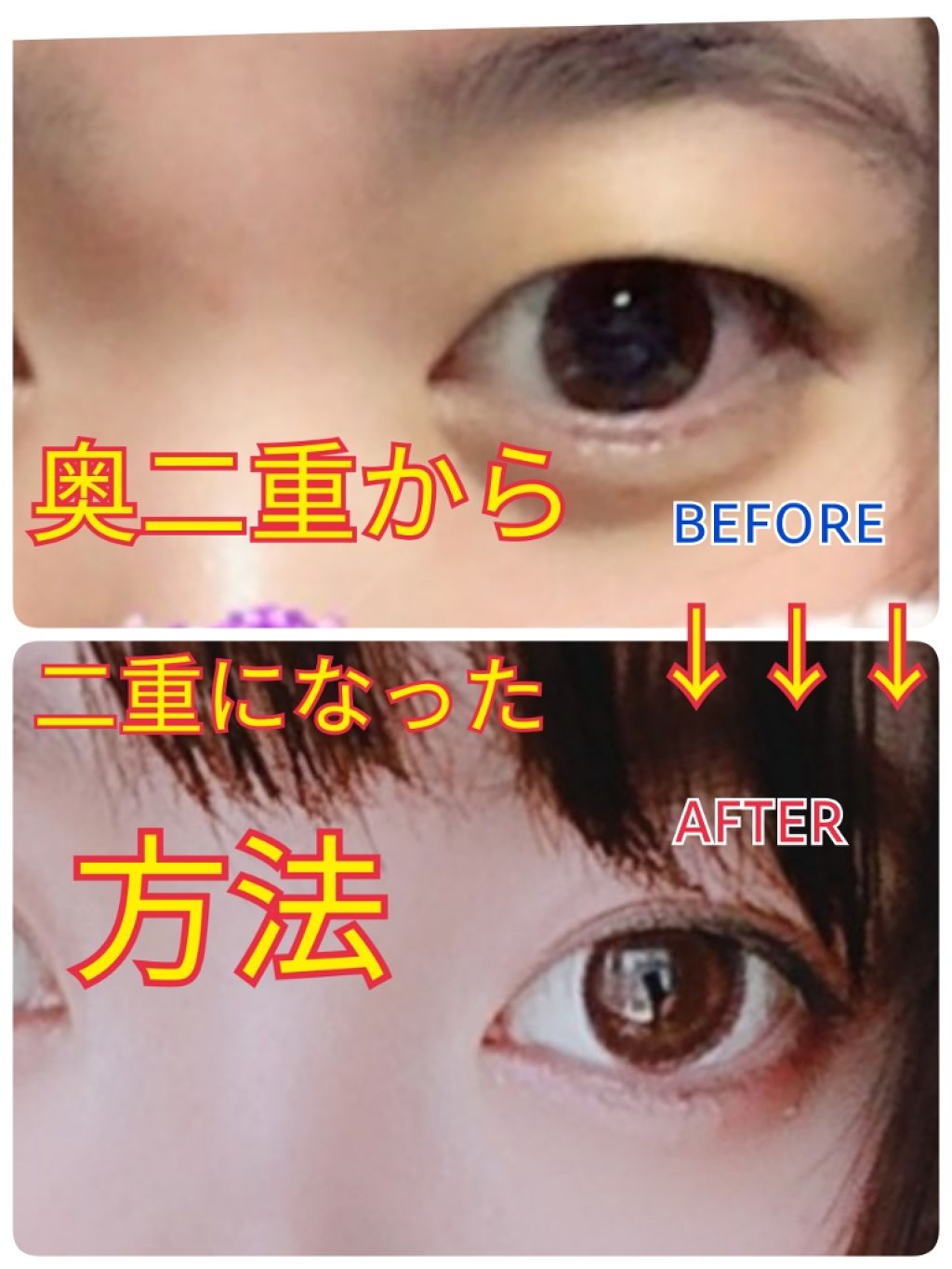 リキッドフィルム/ラクオリ/二重まぶた用アイテムを使ったクチコミ（1枚目）