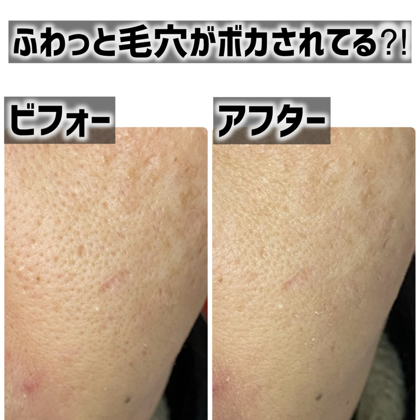 スタジオ フィックス プロ セット ブラー ルース パウダー/M・A・C/ルースパウダーを使ったクチコミ(3枚目)