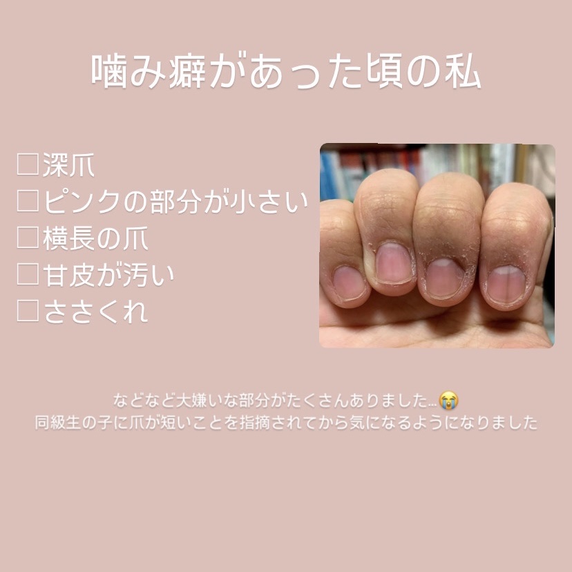 オイルインキューティクルプッシャーペン/ビューティーワールド/ネイル用品を使ったクチコミ（2枚目）