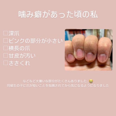 ホホバオイル/無印良品/ボディオイルを使ったクチコミ（2枚目）