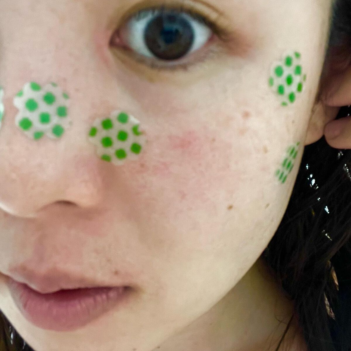 レチノール　シカ　フォーカシングパッチ/innisfree/にきびパッチを使ったクチコミ（3枚目）