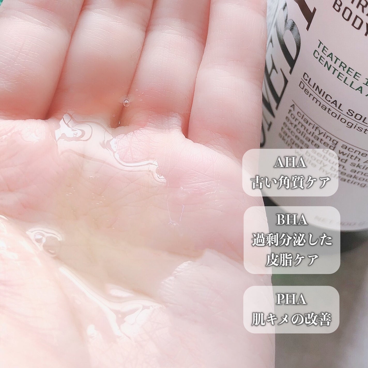 AHA·BHA·PHA 30デイズミラクルアクネボディクレンザー/SOME BY MI/ボディソープを使ったクチコミ(3枚目)