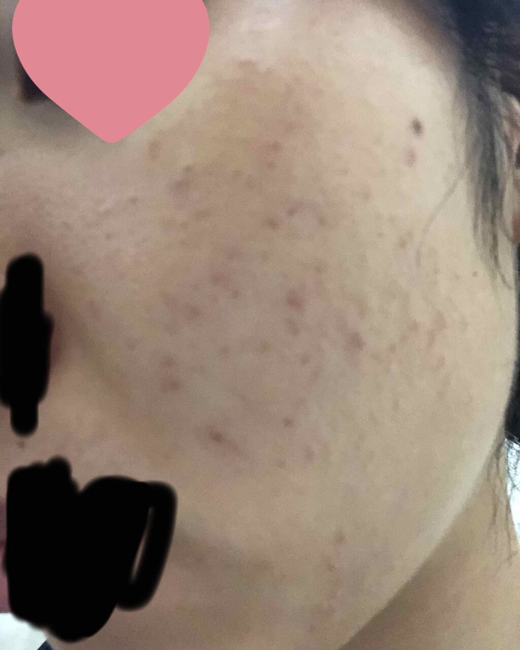 敏感肌用薬用美白美容液/無印良品/美容液を使ったクチコミ（3枚目）