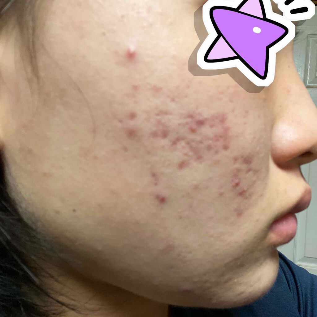 ハトムギ保湿ジェル(ナチュリエ スキンコンディショニングジェル)/ナチュリエ/美容液を使ったクチコミ(2枚目)