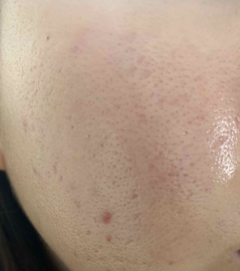 コンシーラー/NOV/クリームコンシーラーを使ったクチコミ(4枚目)