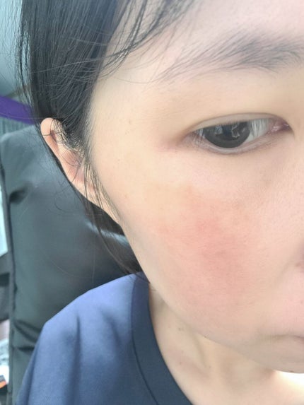 レチノール エキスパート0.1%/IOPE/美容液を使ったクチコミ(5枚目)