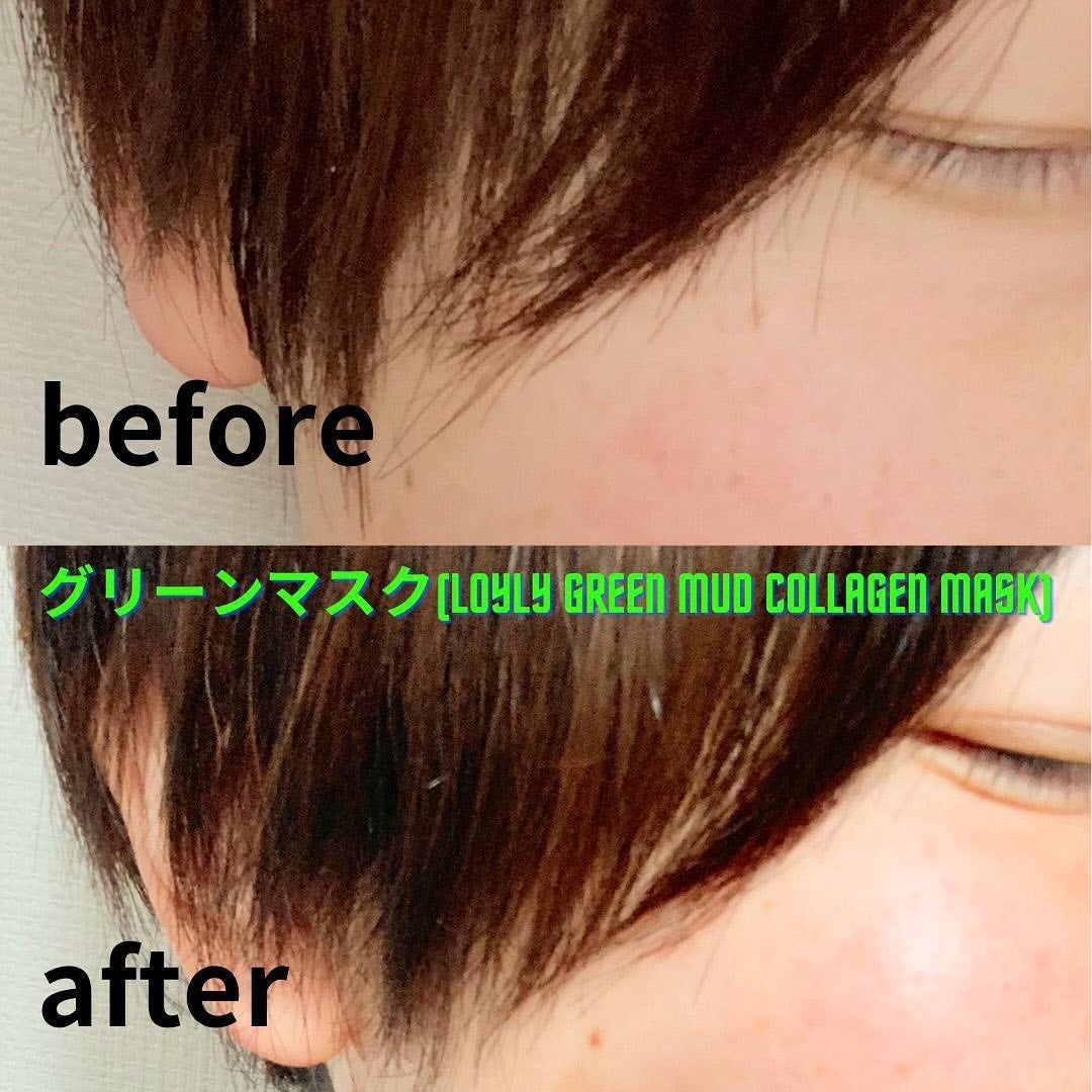 グリーンマスク/Torhop/洗い流すパック・マスクを使ったクチコミ(4枚目)