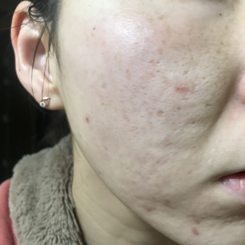 クリームバー ファンデーションN/ナチュラグラッセ/その他ファンデーションを使ったクチコミ（1枚目）