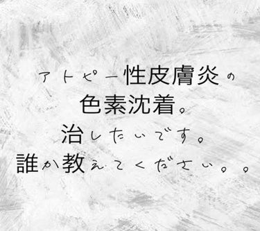 叶実🌹 on LIPS 「アトピー経験者さん教えてください😭私は小さい頃からアトピーに悩..」（1枚目）