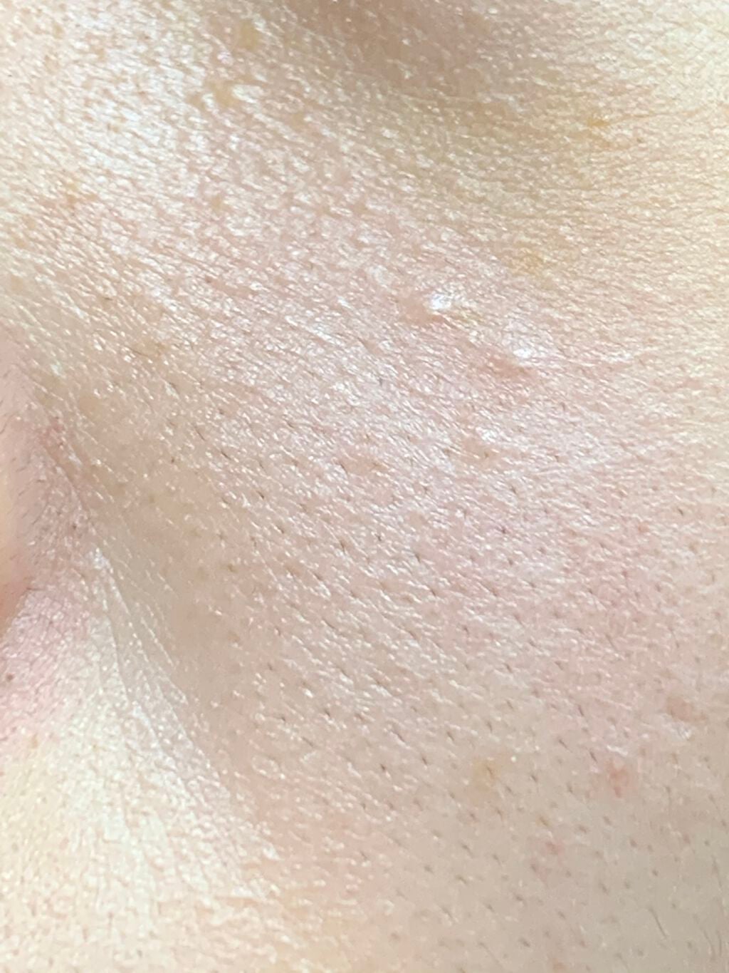 みったんちゃん on LIPS 「【助けて】毛穴?、剃れないレベルの細かな産毛(毛穴汚れに見える..」(4枚目)