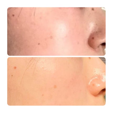 フレッシュリージュースドビタミンドロップ(35ml)/Klairs/美容液を使ったクチコミ(3枚目)