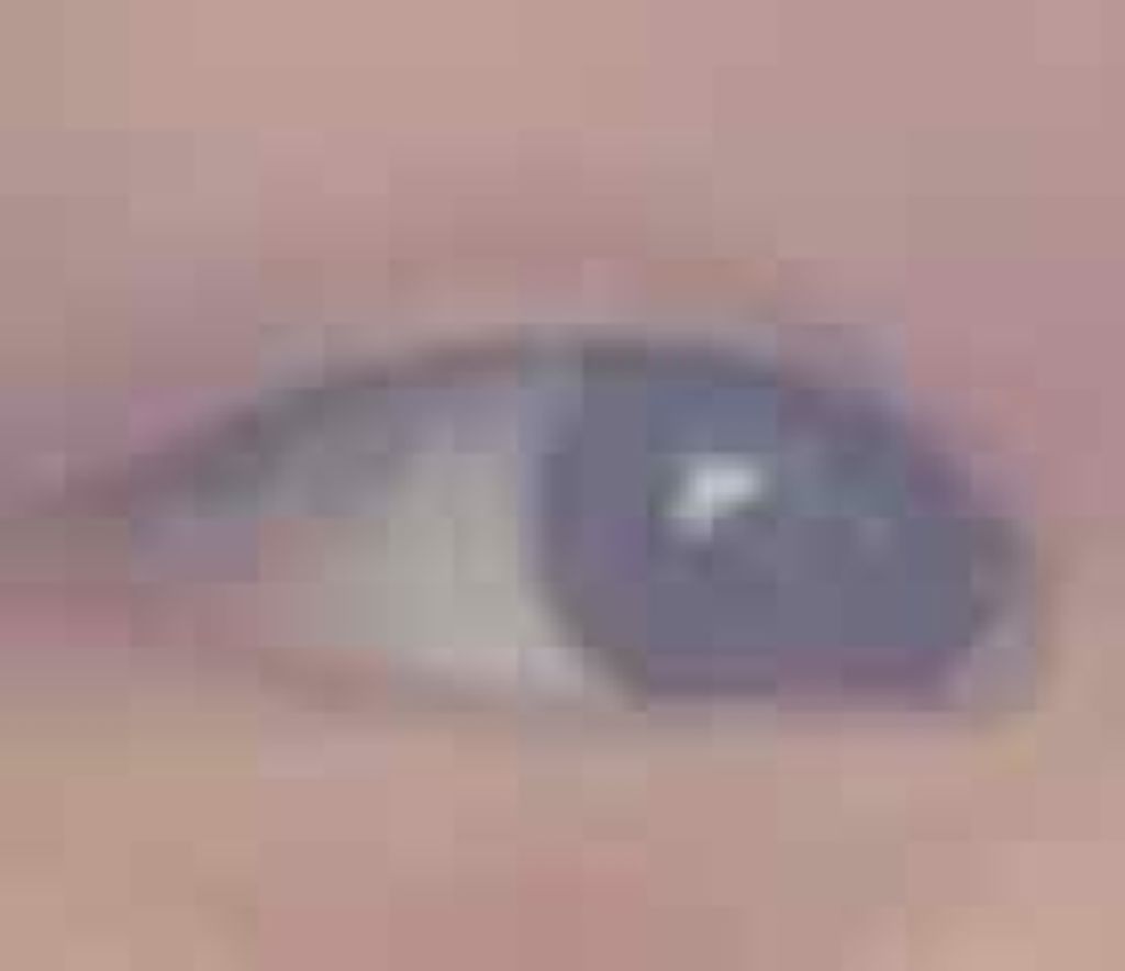 あらきは後頭部ハゲ on LIPS 「⚠️2枚目以降目のどアップ画像苦手な方ごめんなさい🙇♀️こん..」(2枚目)