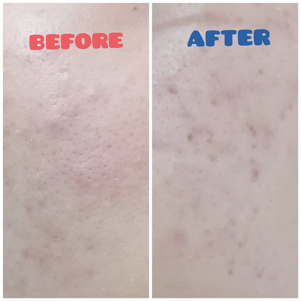 マイルド&モイスチャーアロエジェル/ネイチャーリパブリック/ボディローションを使ったクチコミ(2枚目)