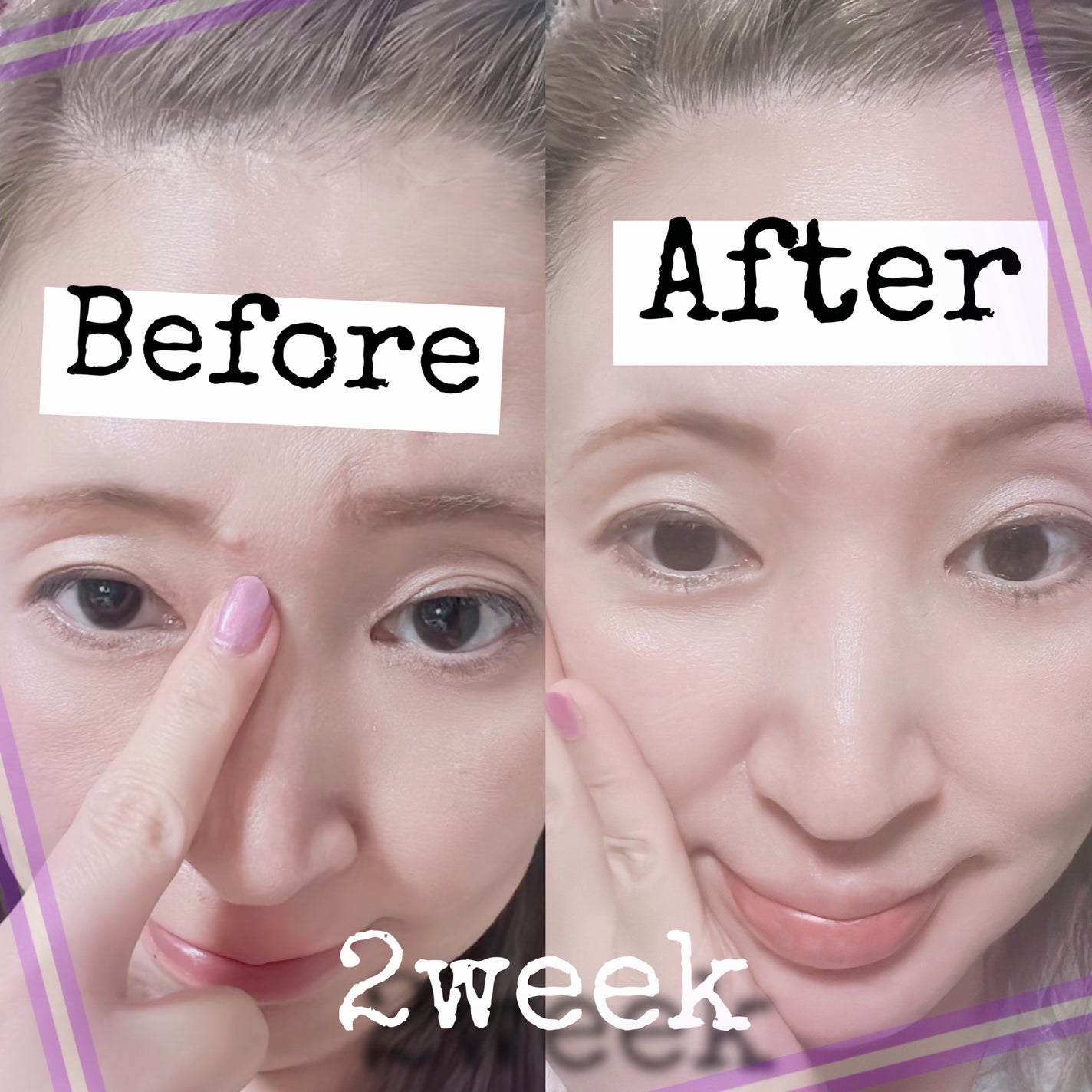 オニオン ニューペア エッセンス トナー/Isntree/化粧水を使ったクチコミ(9枚目)