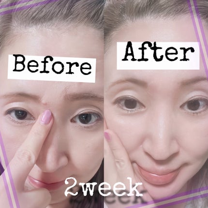 オニオン ニューペア エッセンス トナー/Isntree/化粧水を使ったクチコミ(9枚目)