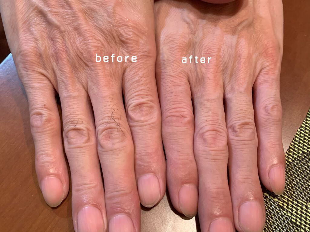 NONON/NONON(ノンノン)/除毛クリームを使ったクチコミ（3枚目）